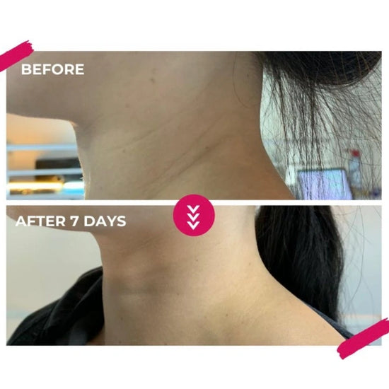 My neck felt more hydrated and firmer after using this Vitamin C serum. It absorbs easily, leaving my skin feeling refreshed and rejuvenated
