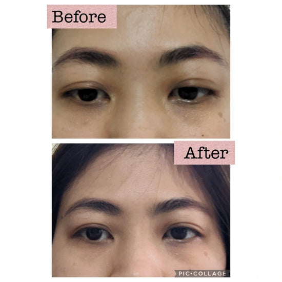 Experience Youth Serum that reduces forehead lines and lightens dark circles in just 3 weeks. Achieve smoother, youthful skin with visible results.